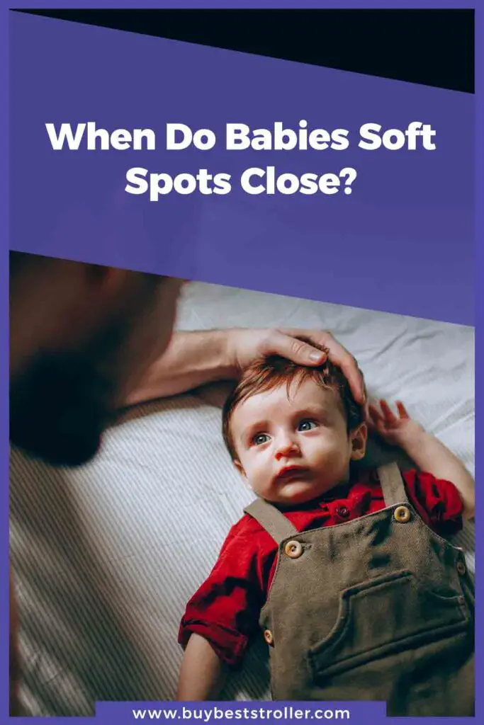 When Do Babies Soft Spots Close