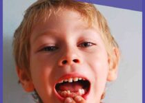 How To Save Baby Teeth For Stem Cells At Home