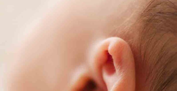 do babies turn the color of their ears