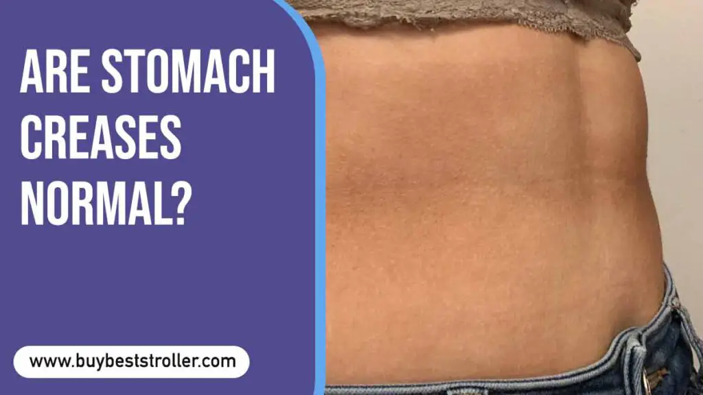 Are Stomach Creases Normal