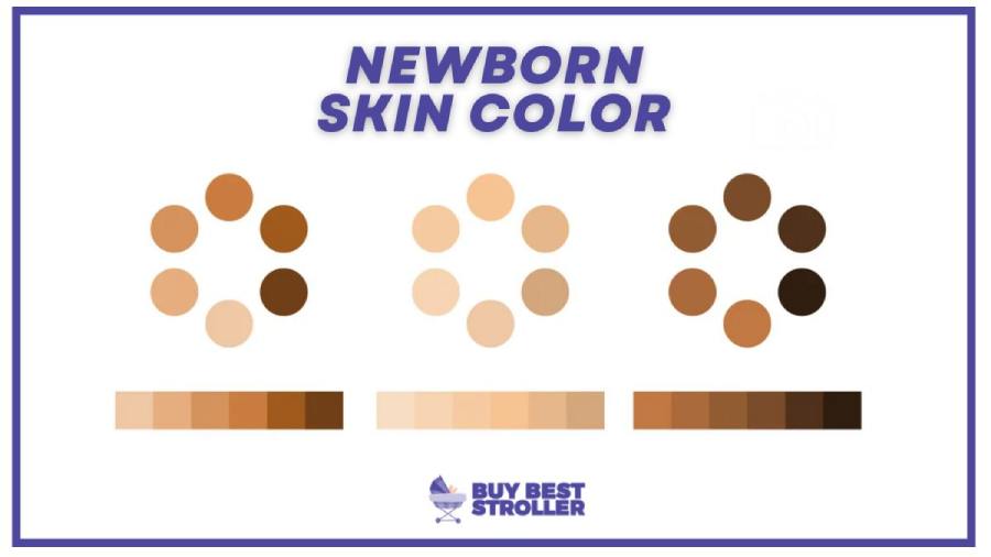Newborn Skin Color 1